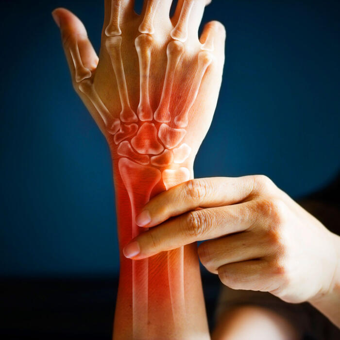 Wrist and hand pain highlighted in red anatomical overlay
